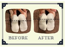 整体院プリュ/Before→ After［19］