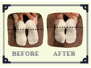 整体院プリュ/Before→ After［19］