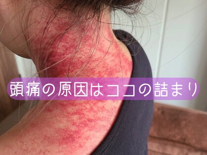 コル コルエ(koru korue)の写真