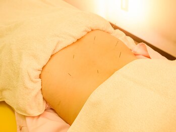 マハロ港南スポーツはりきゅう接骨院/鍼灸で体調管理!