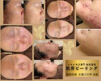アンジェロ