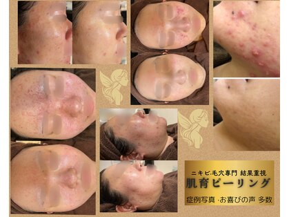 アンジェロの写真