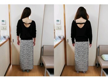 はるかぜ整体院/姿勢の変化を撮りました。