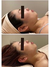 ルナグランデ 心斎橋店(Luna grande.)/驚きの変化