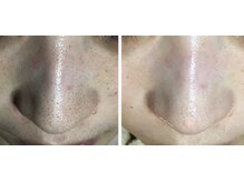 リアン(凛晏)/ビフォーアフター