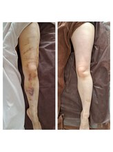 インディバサロン テスタ(testa)/before & after