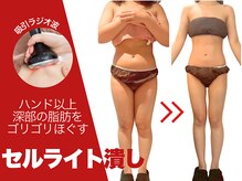 フェムビー 千葉駅前店(FEMBE)の雰囲気（【ぽっこりお腹】運動しても落ちない頑固な脂肪もしっかり分解◎）