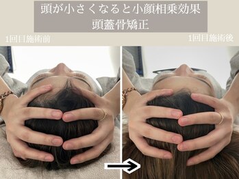 ユウサク(Yusaku)/【頭蓋骨矯正/小顔/本町/梅田】