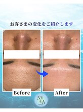 夏秋美肌サロン/Before-After