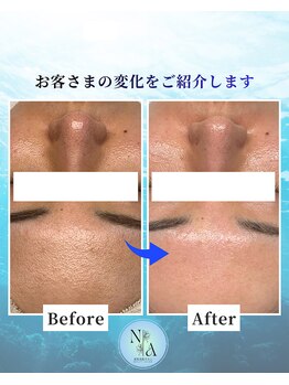 夏秋美肌サロン/Before-After