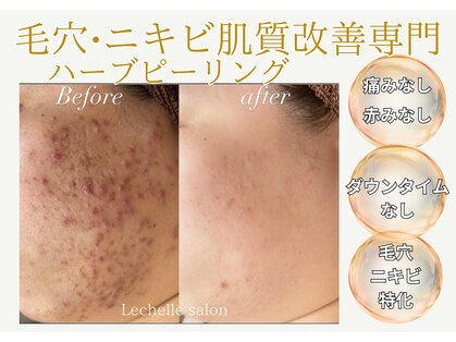レシェルサロン(Lechelle Salon)の写真
