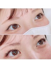 プルメリアラッシュ(PlumeriaLash)/ビューラー式まつげパーマ