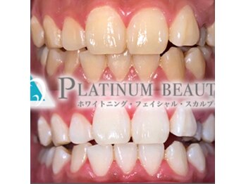 プラチナムビューティー 柏店(PLATINUM Beauty)