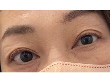 ビューティーアミューズメント 山鼻店(BEAUTY AMUSEMENT)/岩切7月12日