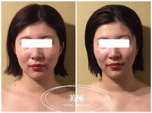 美極 銀座店/銀座/小顔コルギ/小顔矯正