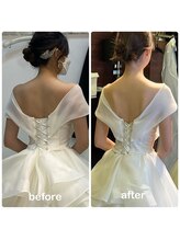 美容矯正専門サロン アカデミア(ACADEMIA)/花嫁様before after　#花嫁美容