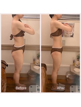 カルナ(carna)/《3か月計6回》2週間に1回