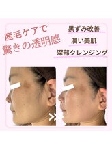 ソラリス(solaris)/フェイシャルWAX