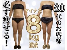 サロン ド ボーテ ラーンジュ 岐阜店(salon de beaut'e L'ange)/ハイパ-ナイフEX2ダイエット痩身