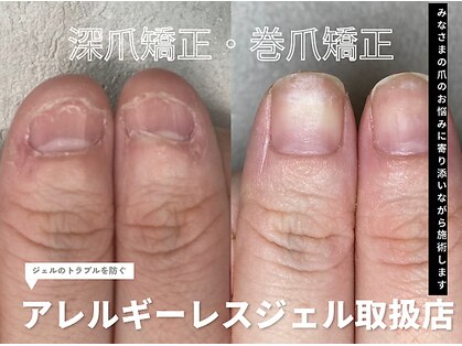 イロドリ(irodori)の写真