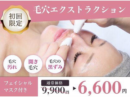 クロス(Xcross)の写真