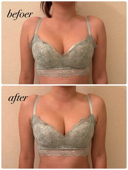 シャルマン(Charmant)/バストケア60分 befoer.after