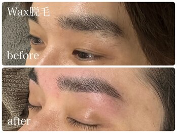 フルミー(fulme.)/WAX脱毛before&after