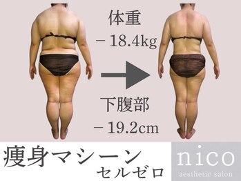 ニコ センター南店(nico)の写真/痩身プログラムがスタート!1台5役のマシーンを使い、気になる脂肪、ボディラインを変えていきます!
