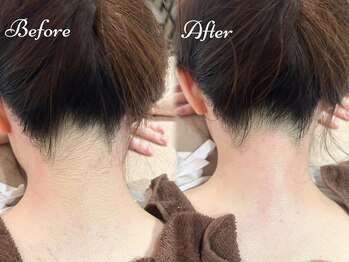 Beauty Salon PIMIL【4/4NEWOPEN(予定)】/うなじ脱毛