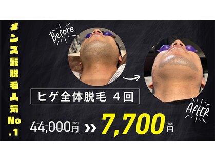 サロンチョコ(salon choco)の写真