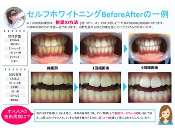 エイチ アンド イー(H&E)/