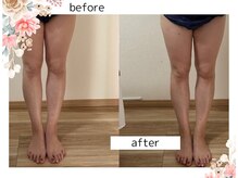 リア(Lia)/このみ式リンパケア修業中　