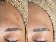 メイン(main)/★before after★