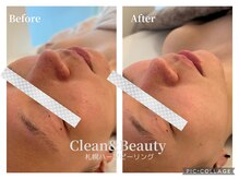 クリーンアンドビューティ 札幌(Clean&Beauty)/自己投資！韓国産製品たくさん♪