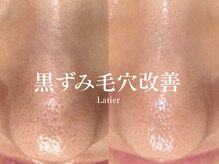 ラティエ(Latier)/黒ずみ毛穴ケアハーブピーリング