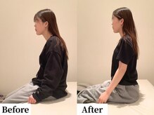 ソレア(Solea)/猫背・肩こり改善1回目