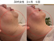 ランティル(l’until)の雰囲気（たるみも小顔も同時に叶う。短期間でスッキリした理想のお顔に）