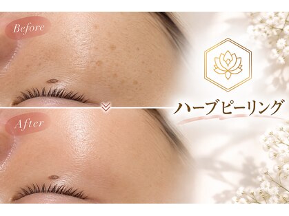 ニューユー(NewYou)の写真