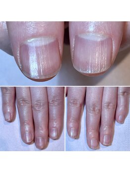 ココデネイル(cocode nail)/悩み:爪の形が…(30代後半)