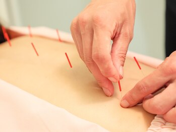 ハリ リリー カニエ/からだの鍼灸