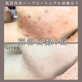 ベルミー(Bellmi)