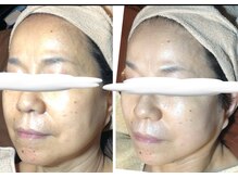 リアン(凛晏)/ビフォーアフター