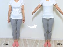 エーアール(AR)/【Before/After】