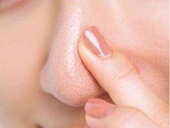 ピービー(PB)の写真/医療提携◇毛穴悩み徹底改善【ハイドラ(毛穴洗浄×ピーリング)¥3990】キメを整え、ざらつき肌をリセット！