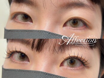 アフェクション アイビューティー(Affection eye beauty)/まつげエクステ