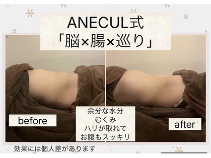 アネクル(ANECUL)の写真