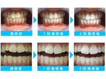 リボーン(REBORN)