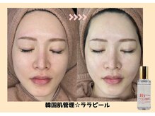 バベルトータルビューティー 北堀江店(Babel Total Beauty)/第4世代【ララピール】
