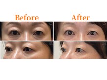 シルエラバレ(CiruelaValle)