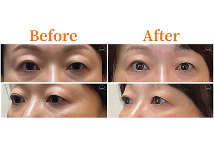 シルエラバレ(CiruelaValle)の写真